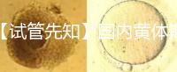 【試管先知】國(guó)內(nèi)黃體期方案經(jīng)驗(yàn)緊缺,2點(diǎn)促排弊端需了解