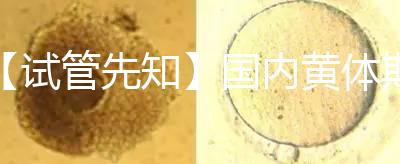 【試管先知】國內(nèi)黃體期方案經(jīng)驗緊缺,2點(diǎn)促排弊端需了解
