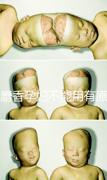 白麝香孕婦不能用有原因，流產、早產…這些危害不得不知