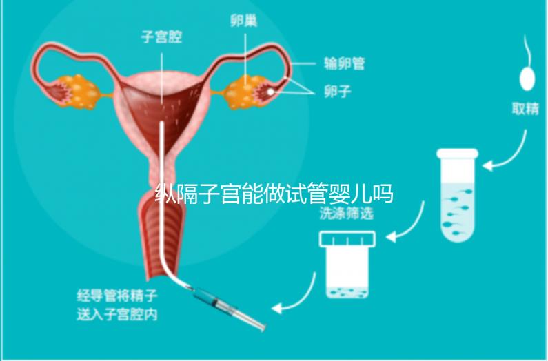 縱隔子宮能做試管嬰兒?jiǎn)?醫(yī)生:可以做，但要手術(shù)治療再進(jìn)周