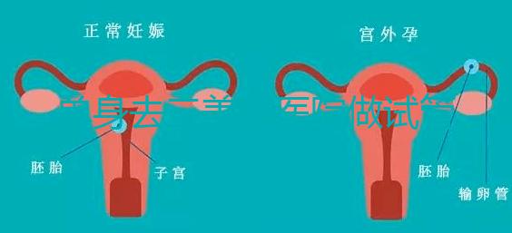 單身去三美泰醫(yī)院做試管需要花費多少錢？費用明細是怎么樣的