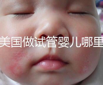 去美國做試管嬰兒哪里最好,4家好評輔助生殖機構推薦