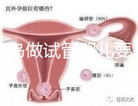 去青島做試管嬰兒要多少錢？