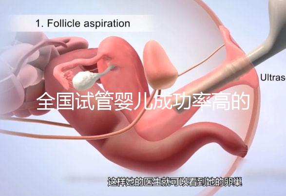 全國試管嬰兒成功率高的醫(yī)院排名，內(nèi)附2023試管費(fèi)用及成功率參考