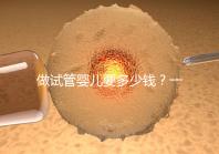 做試管嬰兒要多少錢？一起算筆經濟賬