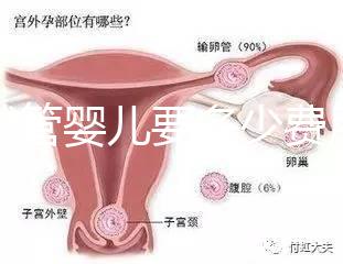 做試管嬰兒要多少費用（做試管嬰兒要多少費用？）