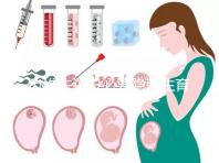 辦準生證沒必要隱瞞生育史，女方再婚需帶離婚證