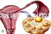 北京哮喘醫(yī)院(北京哮喘醫(yī)院哪家好)