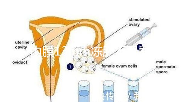 內膜13mm凍胚不易著床要注意，移植與否看醫生怎么說