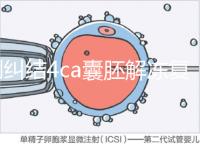 別糾結(jié)4ca囊胚解凍復蘇最早幾天能測出了，著床率先了解下