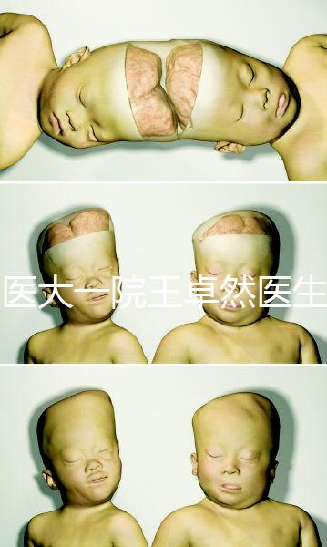 哈醫(yī)大一院王卓然醫(yī)生試管攻略,坐診時(shí)間、成功率早知道