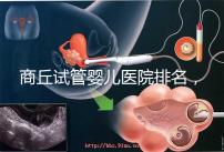 商丘試管嬰兒醫(yī)院排名,附3家公立機構(gòu)助孕成功率和費用