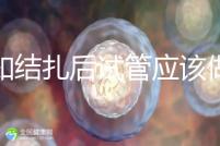 告知結扎后試管應該做什么準備,是否有照片檢查,有答案