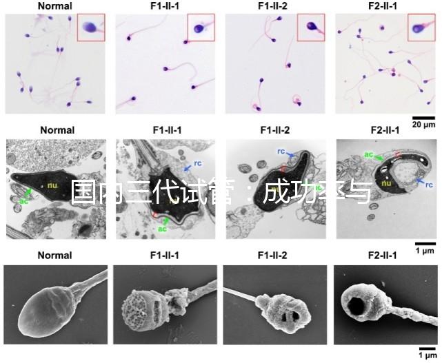 國(guó)內(nèi)三代試管：成功率與費(fèi)用全知曉？