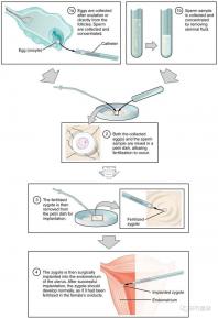 國內(nèi)首起試管嬰兒案例,法律竟難以給患者維權(quán)