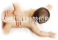 側切傷口紅腫鼓包別擔心,分階段和步驟教你護理