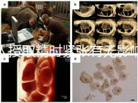 人授取精時(shí)緊張有無影響別還不造,注意事項(xiàng)不少不可不知