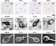 為何試管嬰兒都不順產(chǎn)(為何試管嬰兒都不順產(chǎn)呢)