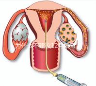 為什么不建議12月齡寶寶打水痘疫苗，醫生道出其中端倪