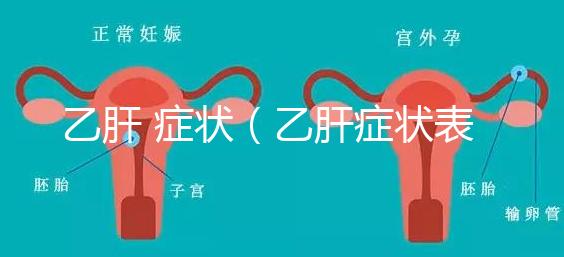 乙肝 癥狀(乙肝癥狀表現有哪些)