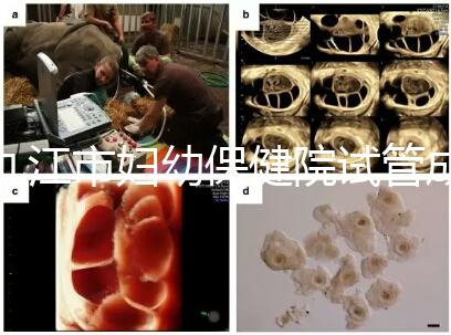 九江市婦幼保健院試管成功率高、費用低?生殖醫(yī)生揭開真相