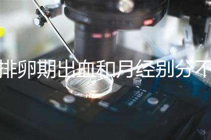 排卵期出血和月經別分不清，4大區(qū)別輕松判斷