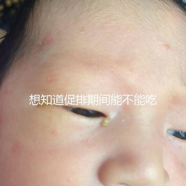 想知道促排期間能不能吃草莓看過來，怎么吃不發(fā)胖有講究