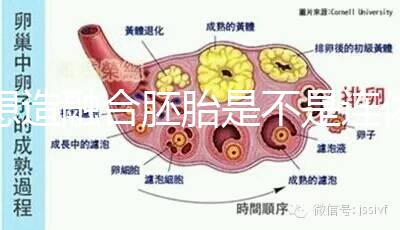 想造融合胚胎是不是連體嬰兒看這，容不容易雙胎一文講清