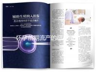 懷孕前期流產的征兆是什么