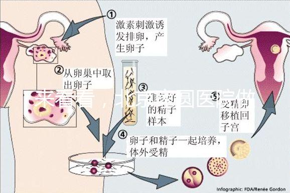 來看看，北京家圓醫(yī)院做三代試管費用總共多少？