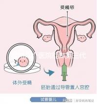 柳州幾個(gè)醫(yī)院能做第三代試管嬰兒?詳細(xì)的費(fèi)用成功率都在這
