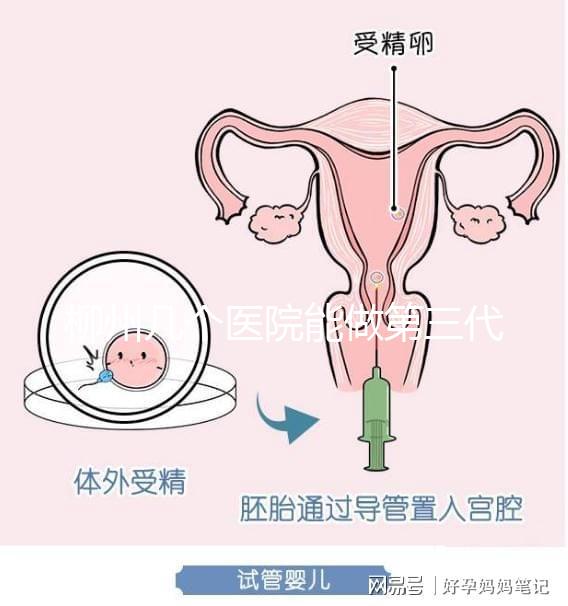 柳州幾個醫院能做第三代試管嬰兒？詳細的費用成功率都在這