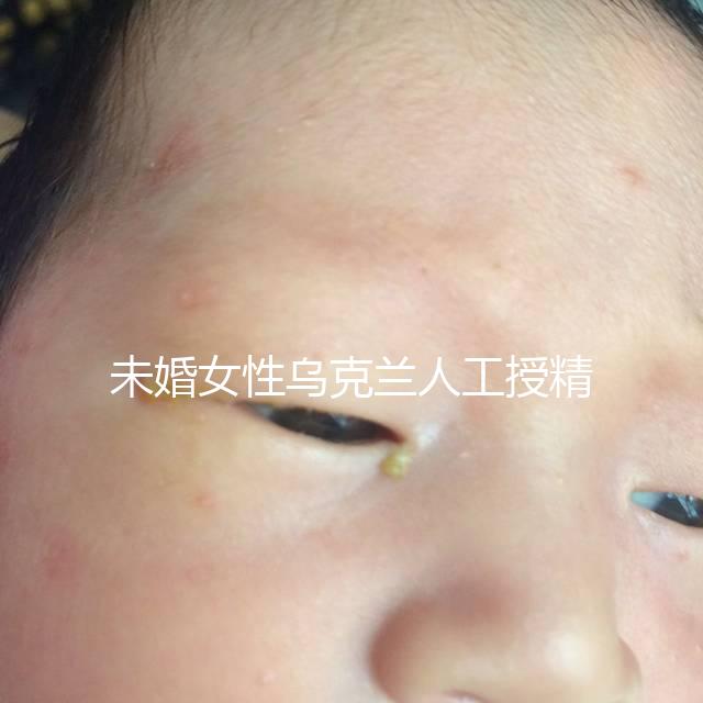 未婚女性烏克蘭人工授精必看！醫療及生活費用明細預覽