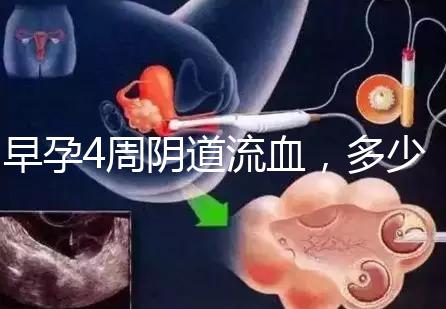 早孕4周陰道流血，多少天檢查血hcg或B超更穩(wěn)妥？