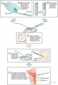 武漢四維彩超費用表整理，內附市婦保院超全預約攻略