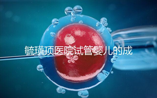 毓璜頂醫(yī)院試管嬰兒的成功率不低,找對生殖科大夫是關鍵