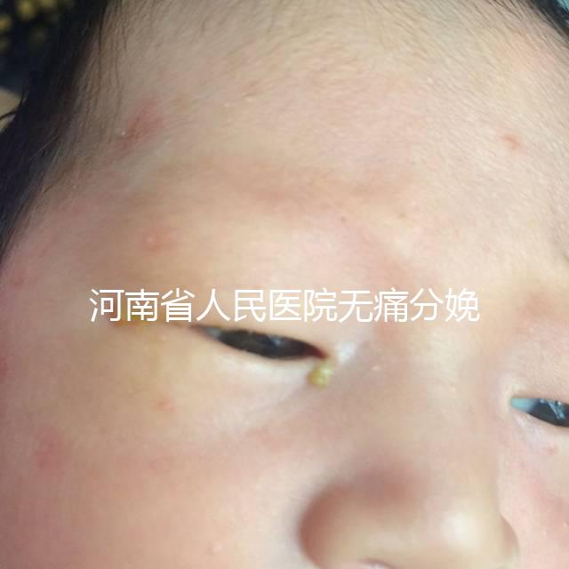 河南省人民醫院無痛分娩多少錢戳，收費標準60s看懂不踩坑