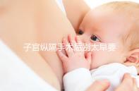 子宮縱隔手術(shù)后別太早要孩子，多久可以懷孕有時(shí)間要求！