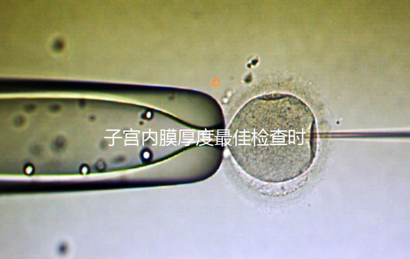 子宮內(nèi)膜厚度最佳檢查時期，你有必要提前知道！