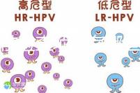 孕前檢查項目有哪些？