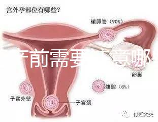 孕婦產前需要注意哪些事項？