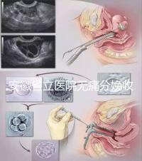 安徽省立醫(yī)院無痛分娩收費標準,過來人經(jīng)歷告訴你怎么樣