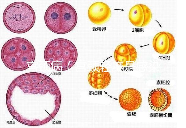 宮頸病(宮頸輕糜是感染了hpv嗎)