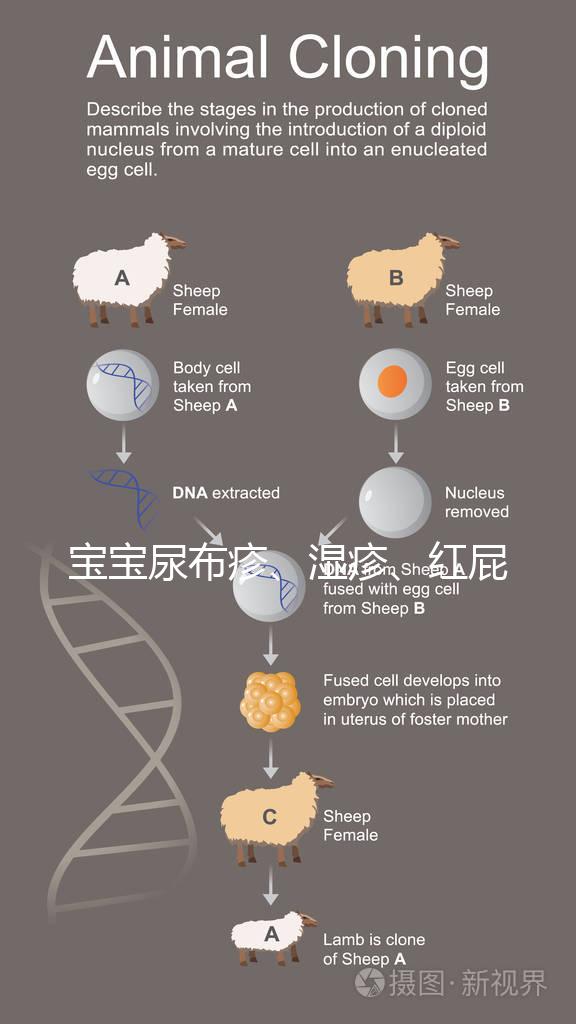 寶寶尿布疹、濕疹、紅屁股傻傻分不清?4點區別輕松診斷