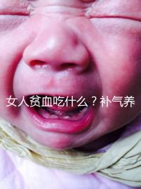 女人貧血吃什么？補氣養血，掌握這五個技巧，讓你煥發青春光彩