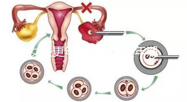女性更年期保?。ǜ昶趮D女保健健康宣教）