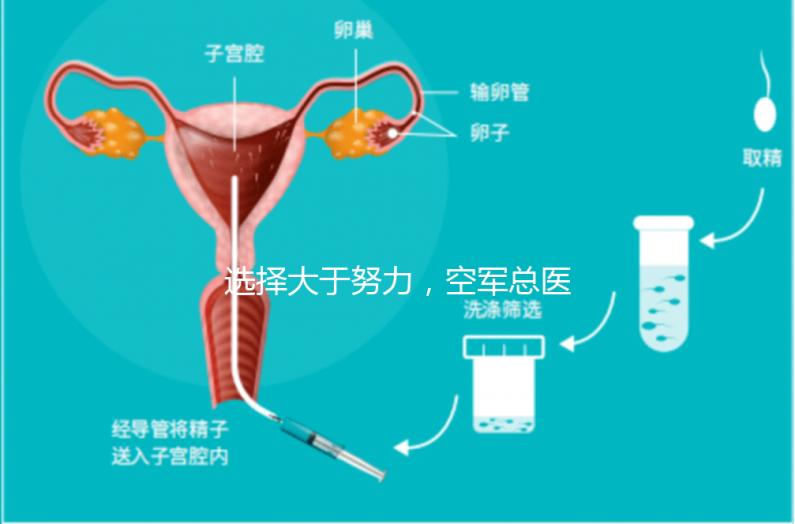 選擇大于努力，空軍總醫院做試管嬰兒必讀攻略