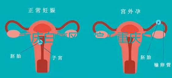 重慶白癜風(fēng)醫(yī)院（重慶白癜風(fēng)?？漆t(yī)院在哪里）