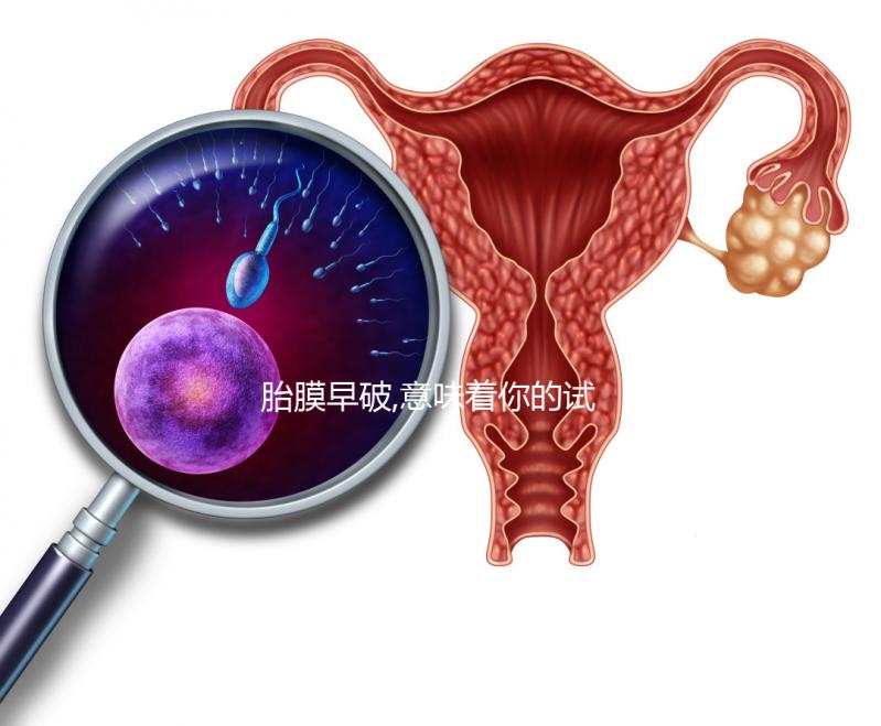 胎膜早破,意味著你的試管嬰兒媽媽夢也破裂了？！