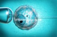 臍帶血捐贈(zèng)后萬(wàn)一自己要用怎么要早知，懷孕的趁早了解